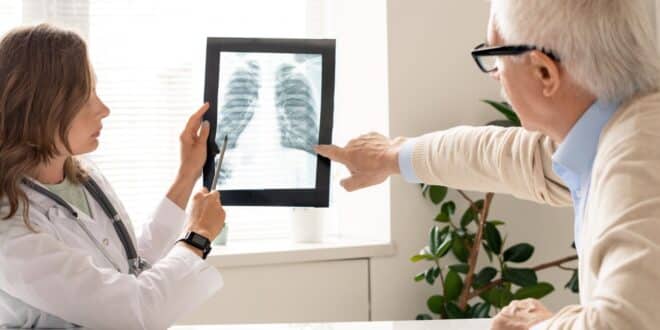 Œdème pulmonaire : combien de temps peut-on vivre avec de l’eau dans les poumons?